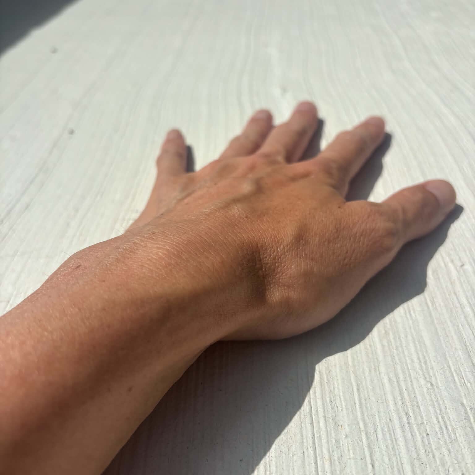 「芝生と同じ温度です」照り返し対策