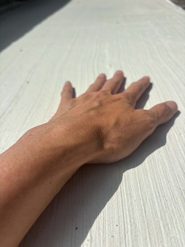 「芝生と同じ温度です」照り返し対策